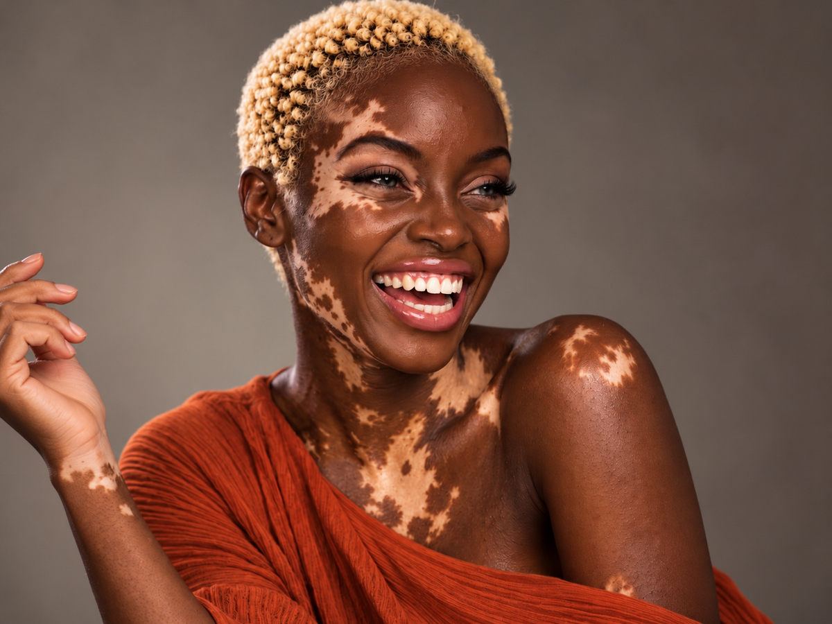 AI-created smiling female model with short blonde curls, visible vitiligo-inspired skin pigmentation and an orange outfit, celebrating beauty in all shades.